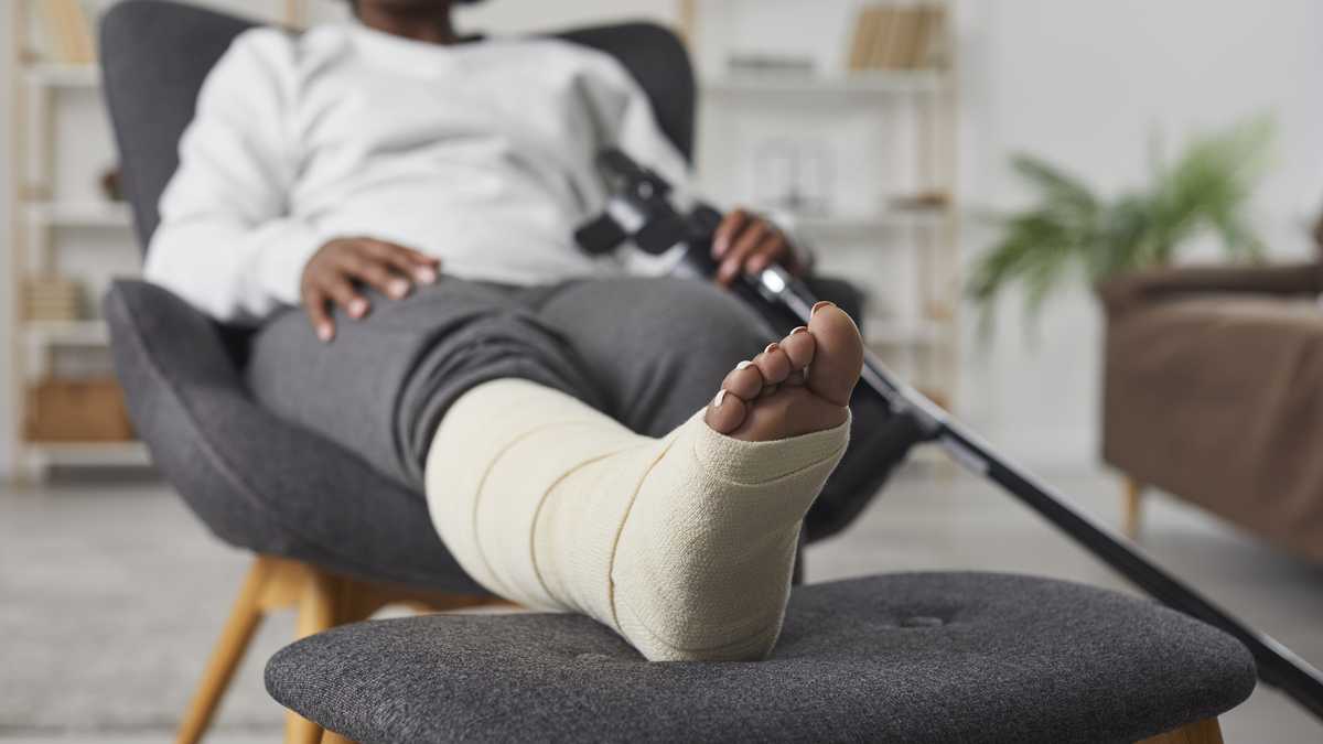 I was stuck at home with a broken leg — Then I discovered who my fiancé really was