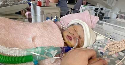 Leicestershire tot left blind and unable to speak after two cardiac arrests