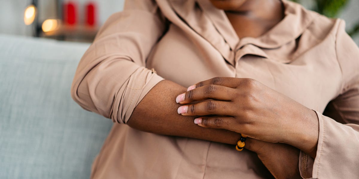 Bed Bug Bites Vs. Flea Bites: How to Tell the Difference, According to Experts