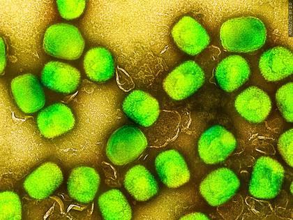Comment on Second probable monkeypox case detected in Santa Cruz County by Frankie Bleddyn