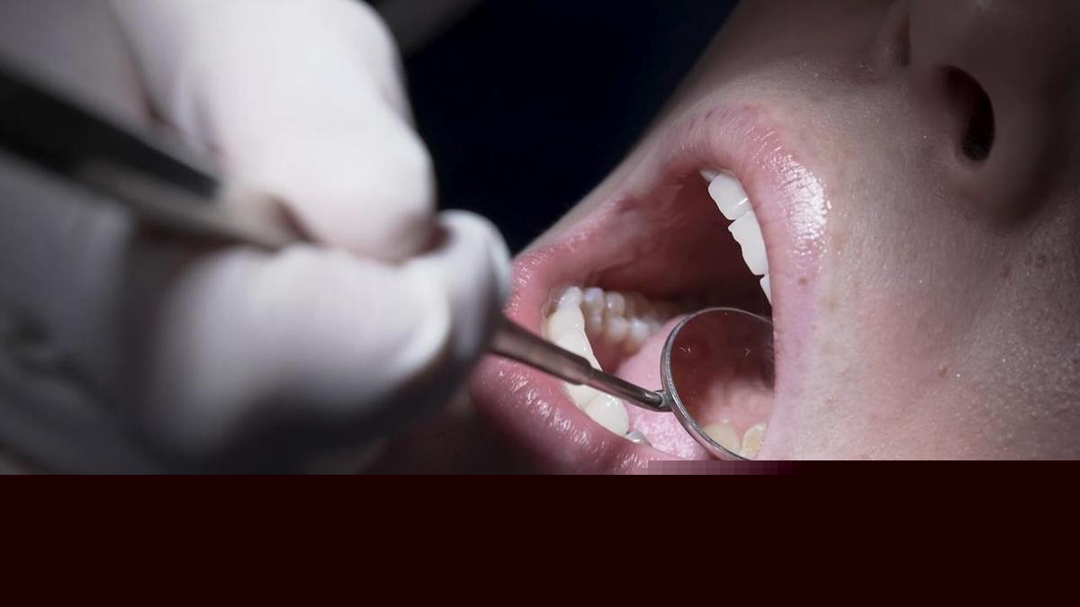 Young people brushing dental health aside, experts warn
