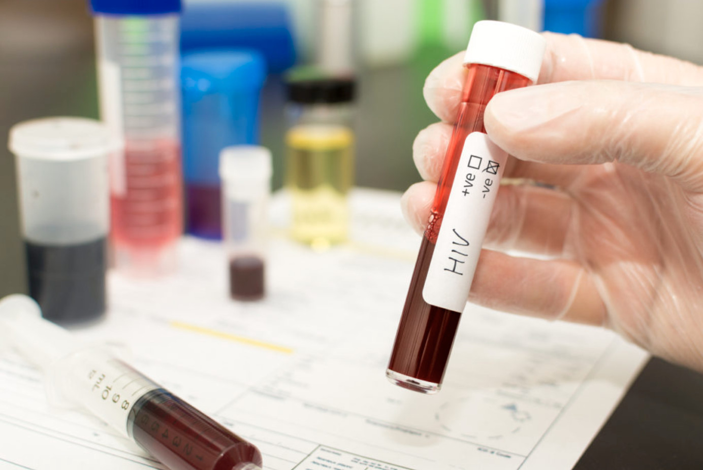 Kelowna residents complain about long waits for service at Dynacare labs (Kelowna)