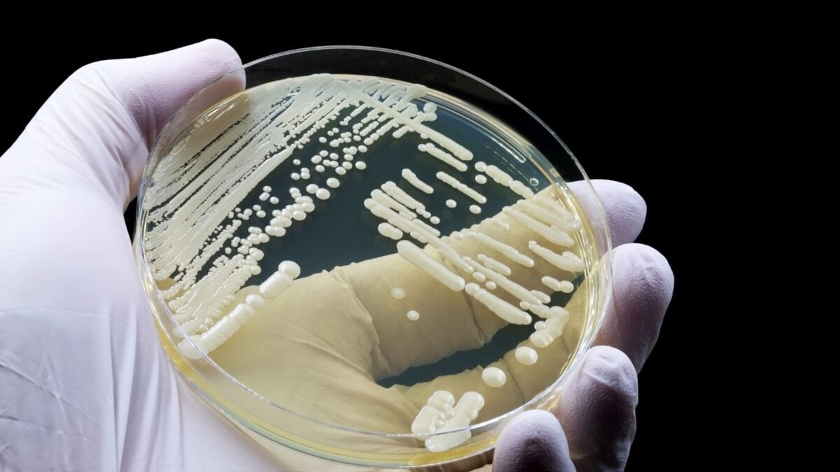 This Deadly Drug-Resistant Fungus Can Lurk in Your Skin. Scientists Just Discovered How