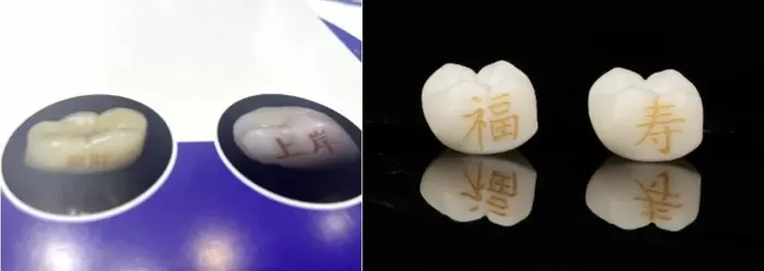 Bored with Skin Tattoos, Chinese Youths Are Increasingly Turning to Tooth Tattoos Instead