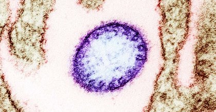 What is the Nipah virus? Two confirmed cases spark airport screening across Asia