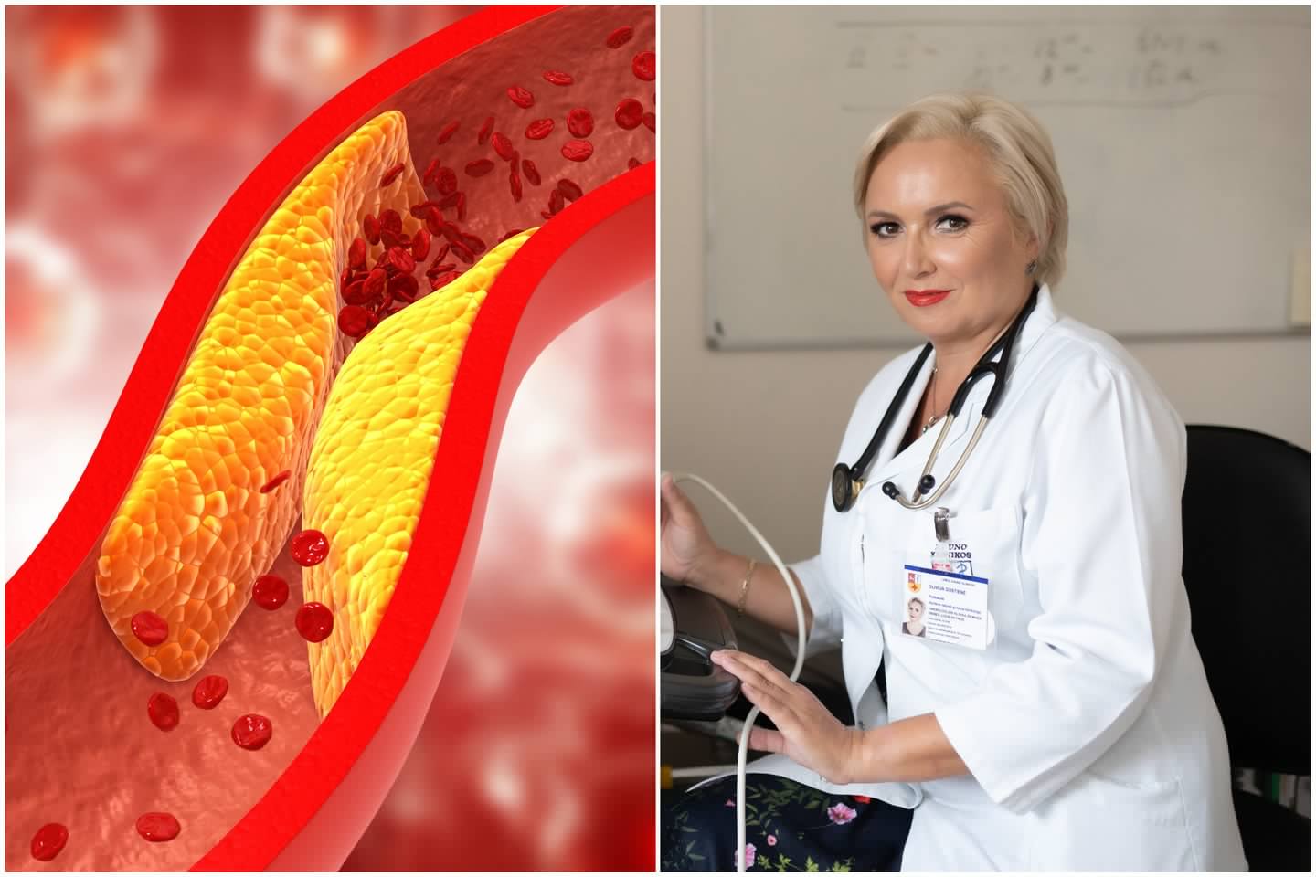 Kardiologai kelia raudoną vėliavą: dėl vaistų nuo cholesterolio – Lietuva paskutinė Europoje