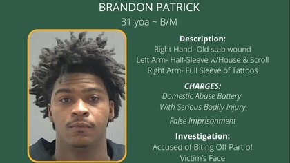 Tangipahoa deputies searching for man who allegedly held woman against her will, bit off part of her face