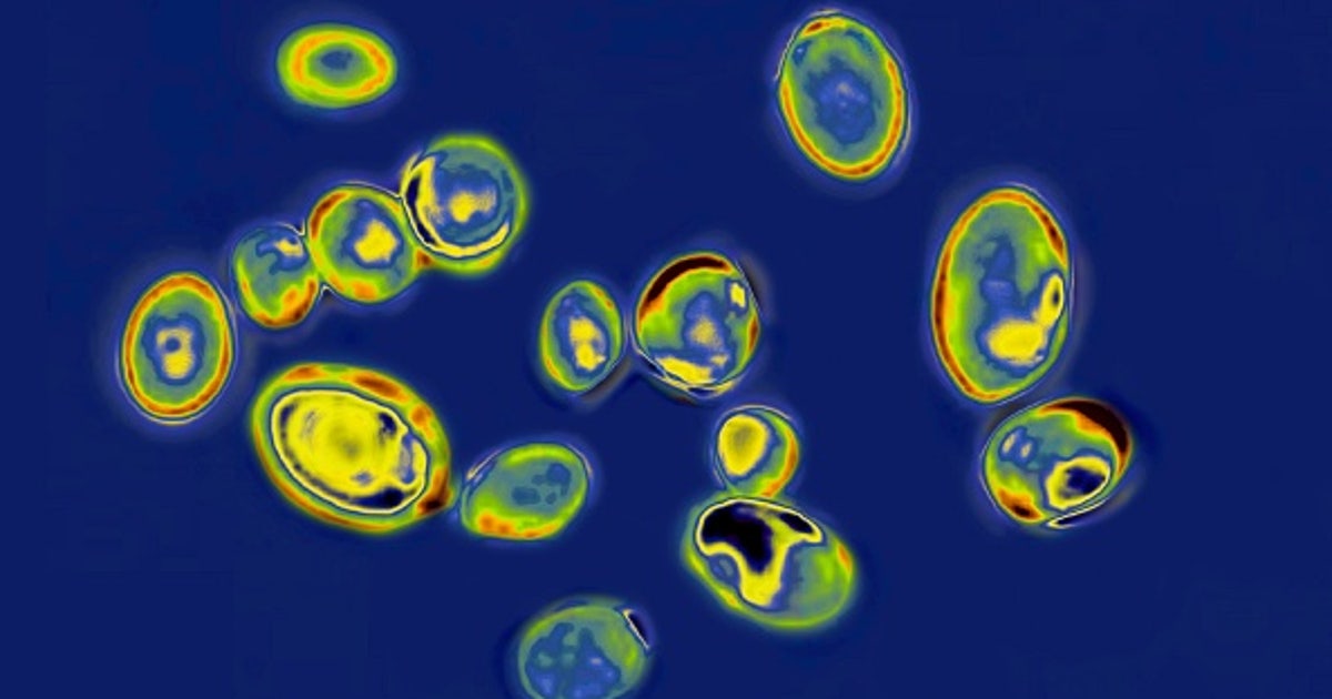 CDC: 13 cases in 2026 of new fungus in WA