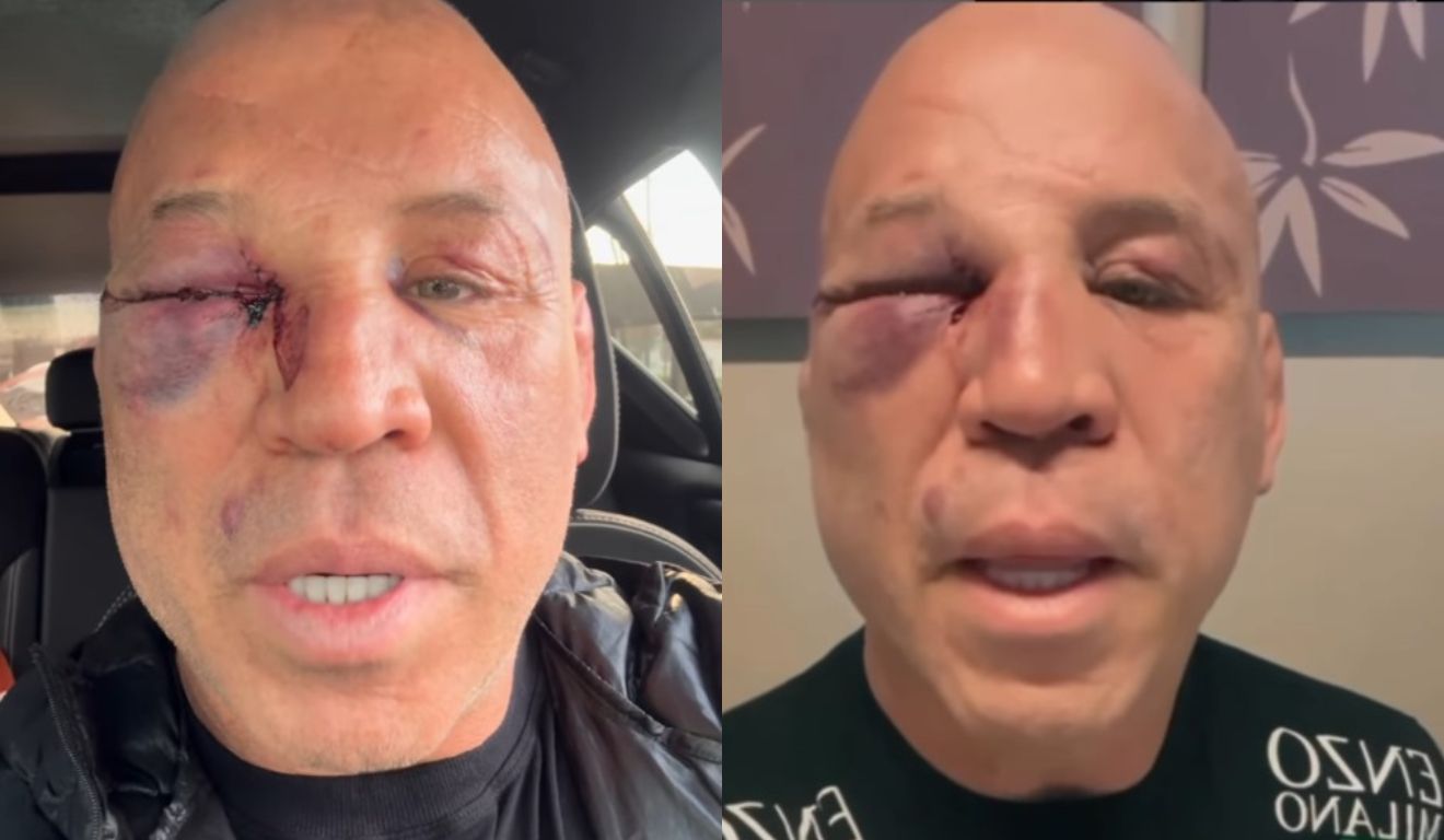 Wanderlei Silva promete ir à Justiça por agressões sofridas em confusão: “Não consigo dormir”