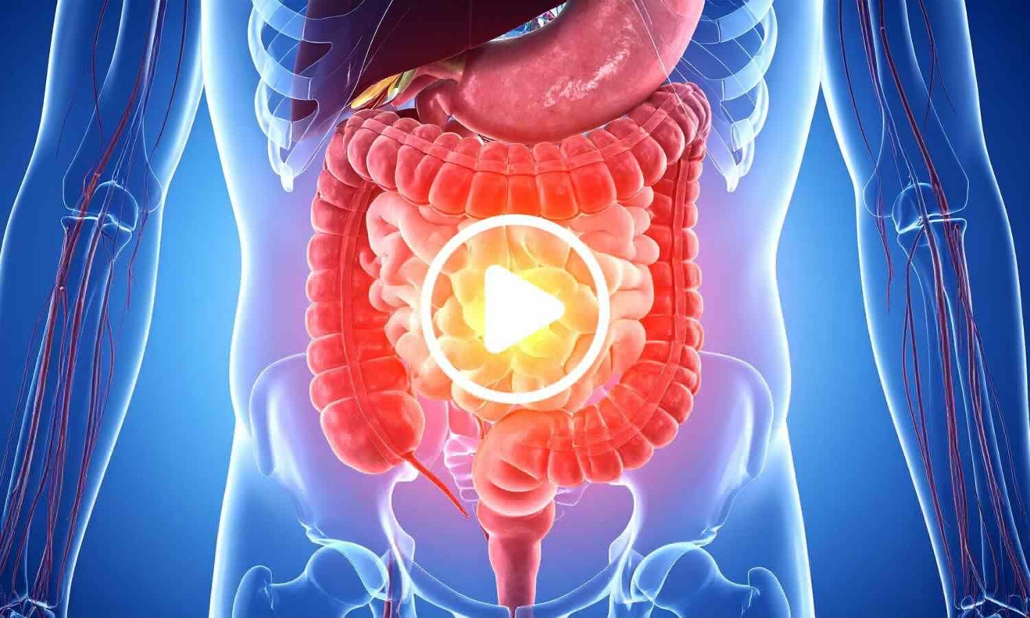 New Study Links Plant-Based Diets to Healthier Gut Microbes and Metabolites