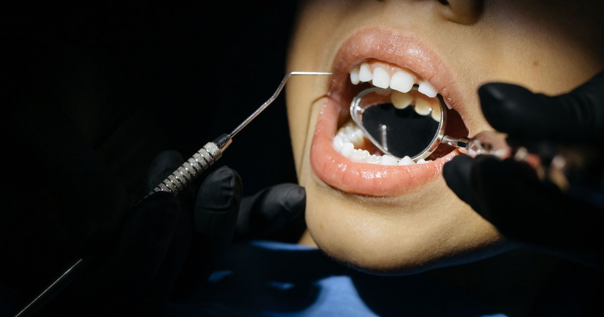Liquid cavity treatment, used in other countries, could benefit U.S. kids, researchers say
