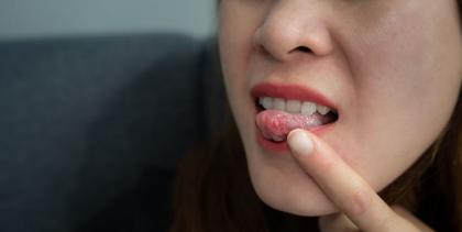 What Causes Painful Tongue Bumps and How to Treat Them, According to Dentists