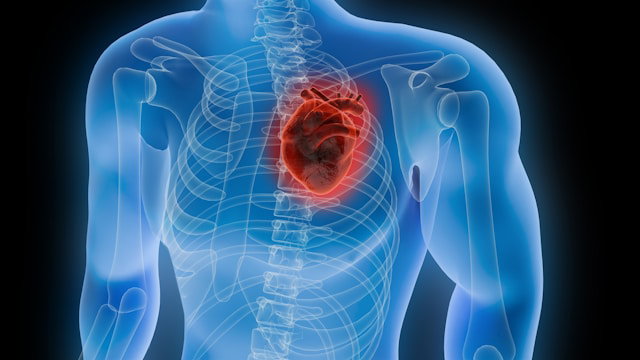 Why Irregular Heartbeat Start After Heart Attacks