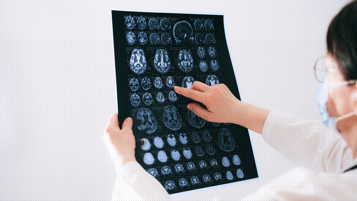 "Je pensais simplement que j'étais fatigué" : sa femme le pousse à aller chez le médecin alors que son mal de tête persiste depuis dix jours, on lui diagnostique un cancer du cerveau incurable