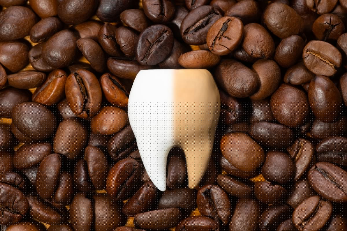 ¿Cómo tomar café sin dañar tus dientes? Datos clave y hábitos de cuidado diario