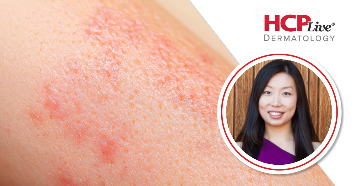 <![CDATA[Spotlighting Pediatric Dermatology Updates for 2026, With Dawn Eichenfield, MD, PhD]]>
