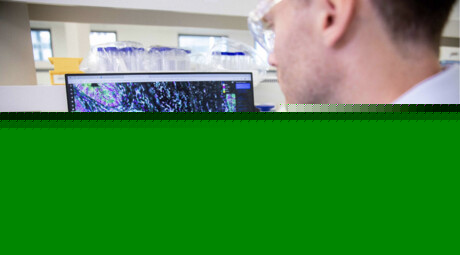 Could this human tissue biobank find the cause of a bowel cancer surge?