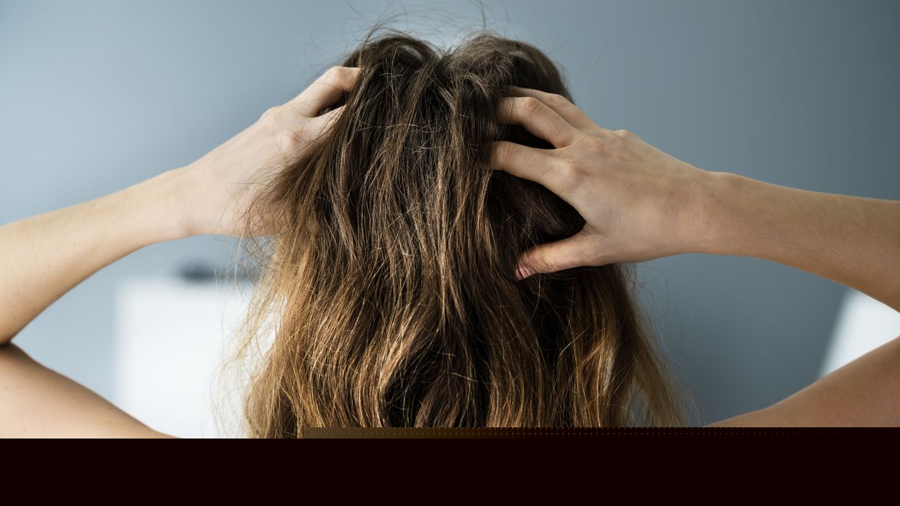 How to Get Rid of Dandruff, According to Dermatologists in 2026