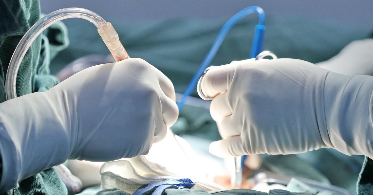 A Torino è stato reinnervato un pene per la prima volta al mondo
