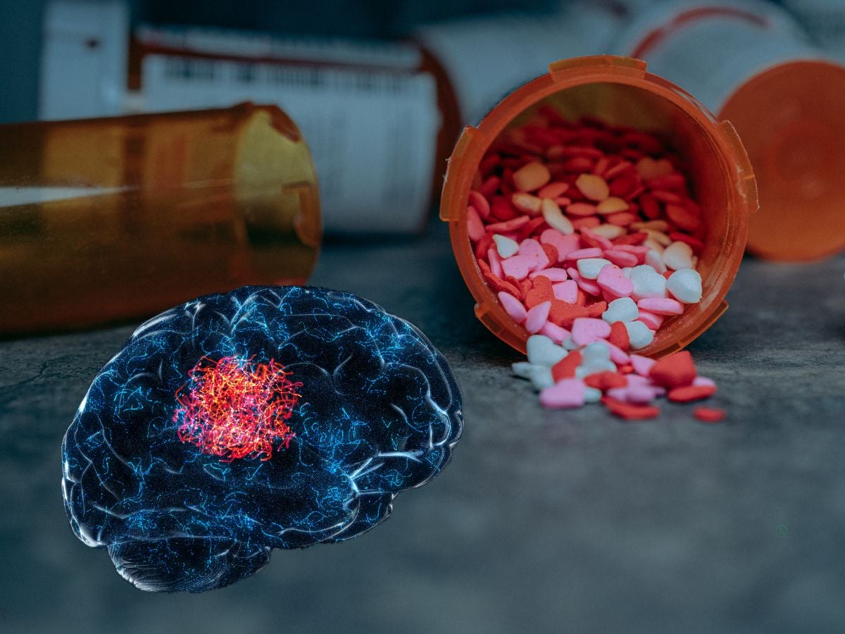 Fármaco para hipertensión detiene crecimiento de cáncer cerebral