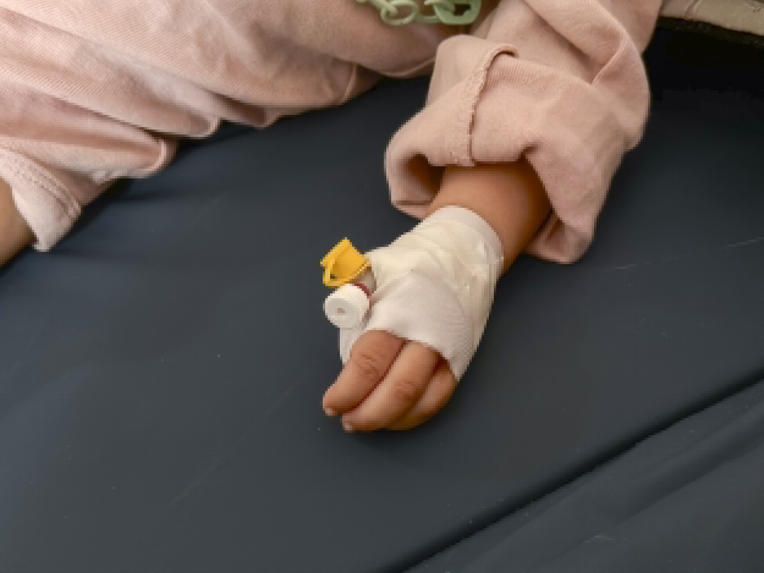 Children With Severe Pneumonia Did Well After an Earlier Switch to Oral Antibiotics, Trial Finds