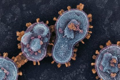 Health Alert Deadly Nipah Virus in India Asia on High Alert and Aotearoa Watching Closely