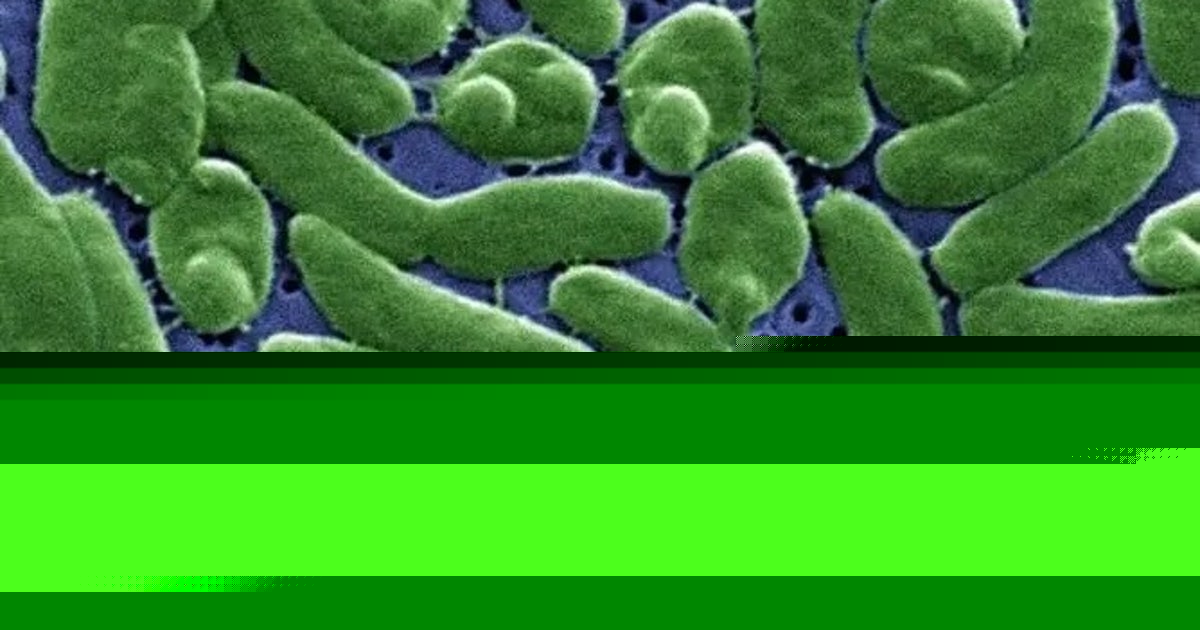 Case tracker: Here is where flesh-eating bacteria cases have been reported in the US