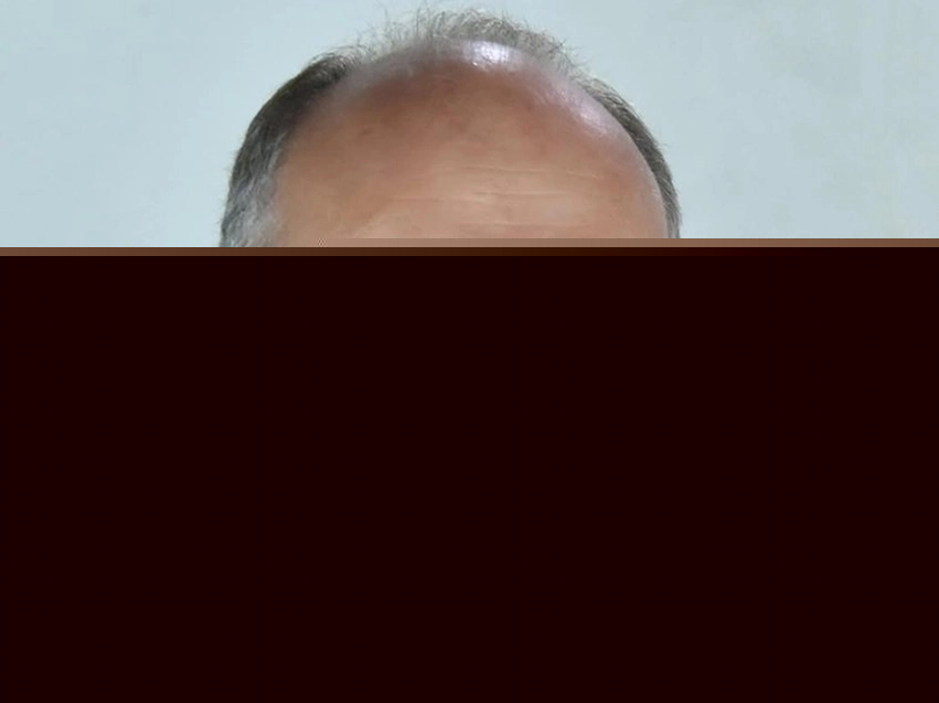 Amaneti nën arrë