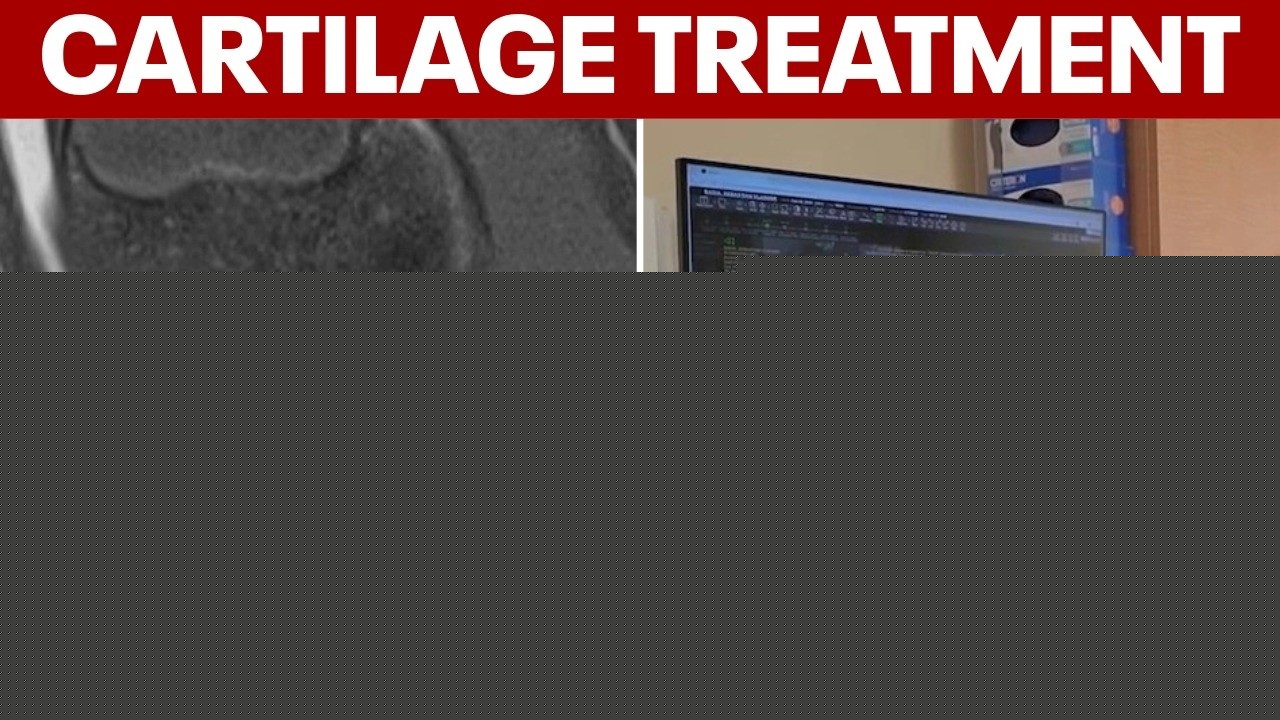 New treatment for cartilage problems