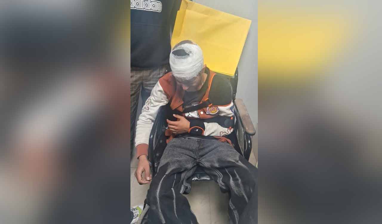 Kashmiri shawl seller injured in alleged mob attack in Uttarakhand