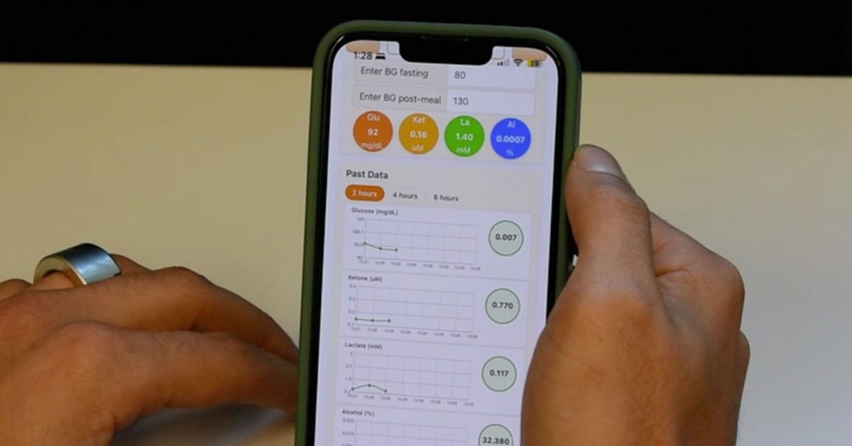 Prototype smart ring cracks the holy grail of non-invasive blood sugar measurement