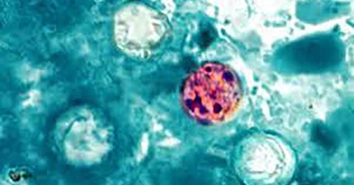 Taylor Farms cyclospora finding was a false positive, FDA says