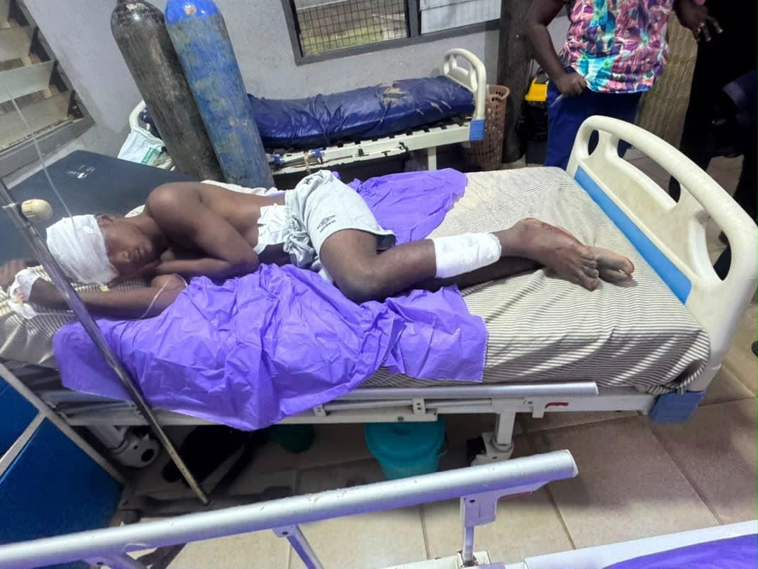 Police Probe Illegal Explosives As Aboso Blast Death Toll Stays At Three