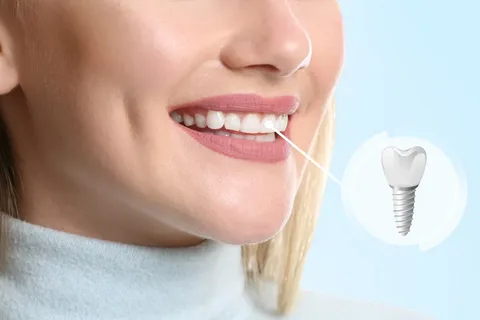 Experience Top-Notch Emergency Dental Care in Vancouver