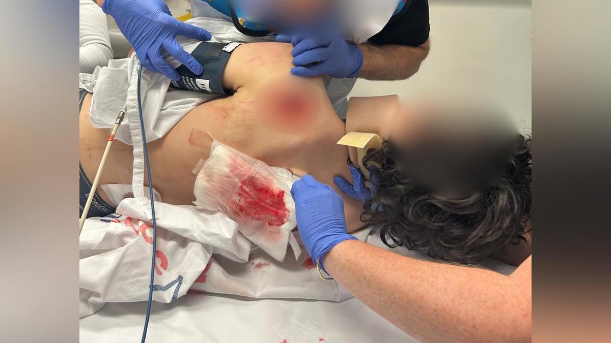 Teen slashed with machete as attackers steal e-bike