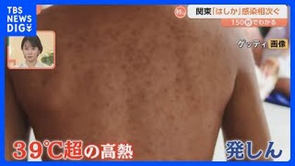 Highly Contagious Measles Cases Reported Across the Kanto Region
