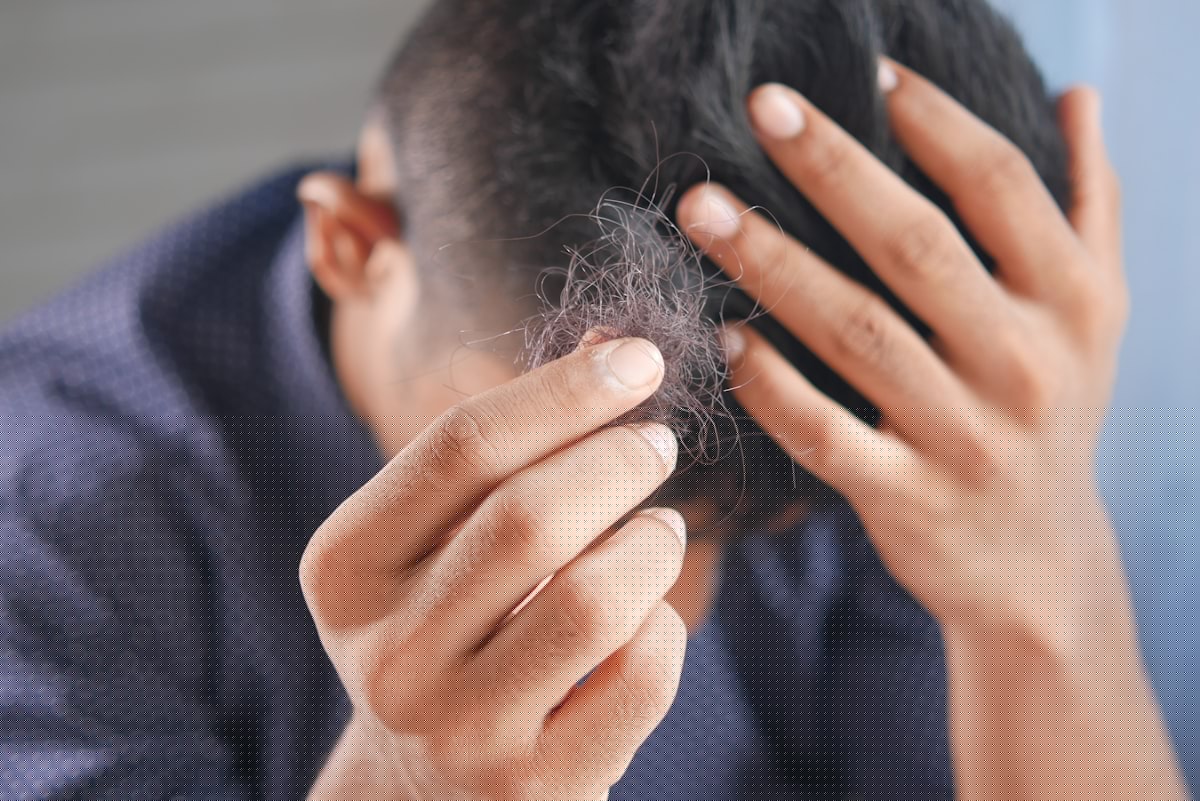 Study Finds New Jersey Residents Are Scared Of Losing Their Hair