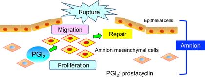 Study uncovers crucial role of prostacyclin in fetal membrane healing