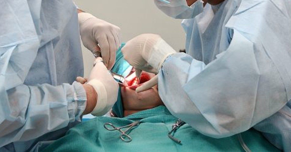 “Mi hanno tolto 11 denti in quattro ore, stavo malissimo. Non riuscivo più a mangiare e a parlare”: due odontoiatri condannati a Torino