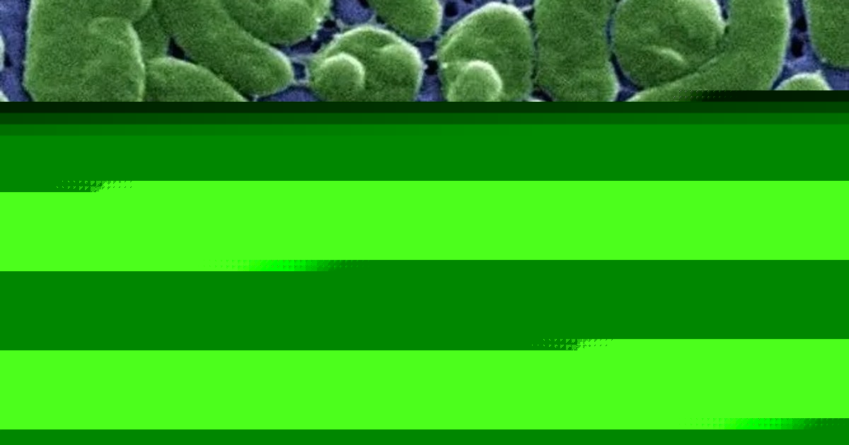 Case tracker: Here is where flesh-eating bacteria cases have been reported in the US