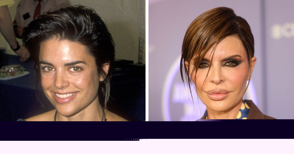 Earlier Looks: Celebrity Faces Before And After Plastic Surgery