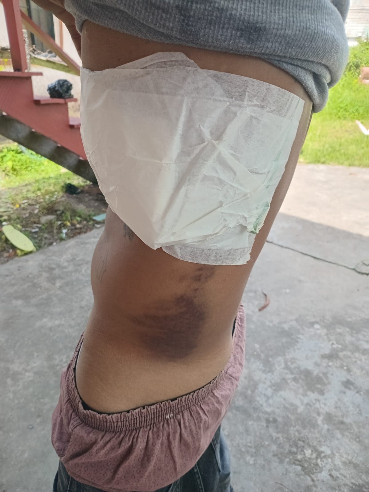La Grange man to sue CANU over alleged attack