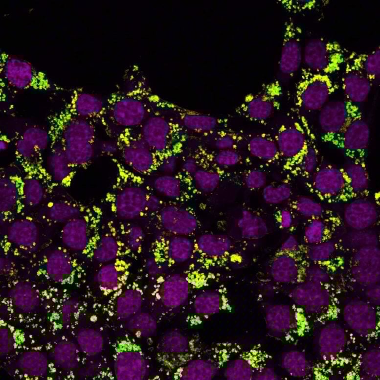 Viagra May Block a Hidden Pathway Cancer Cells Need To Spread