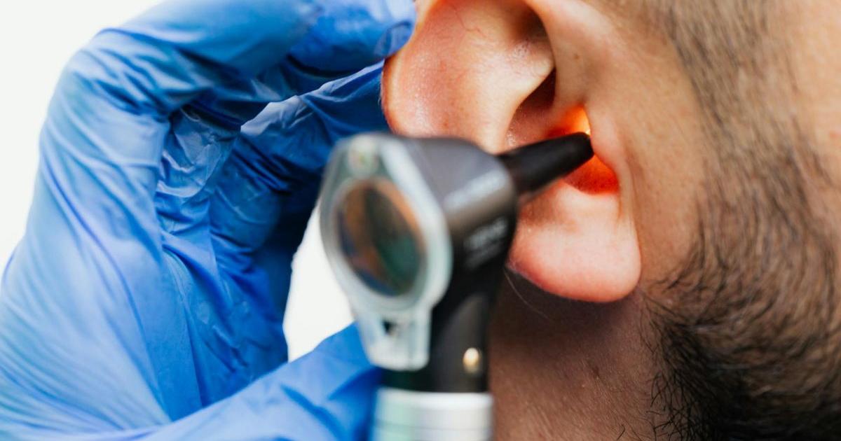 'Lots of people can live well with tinnitus' with the right support