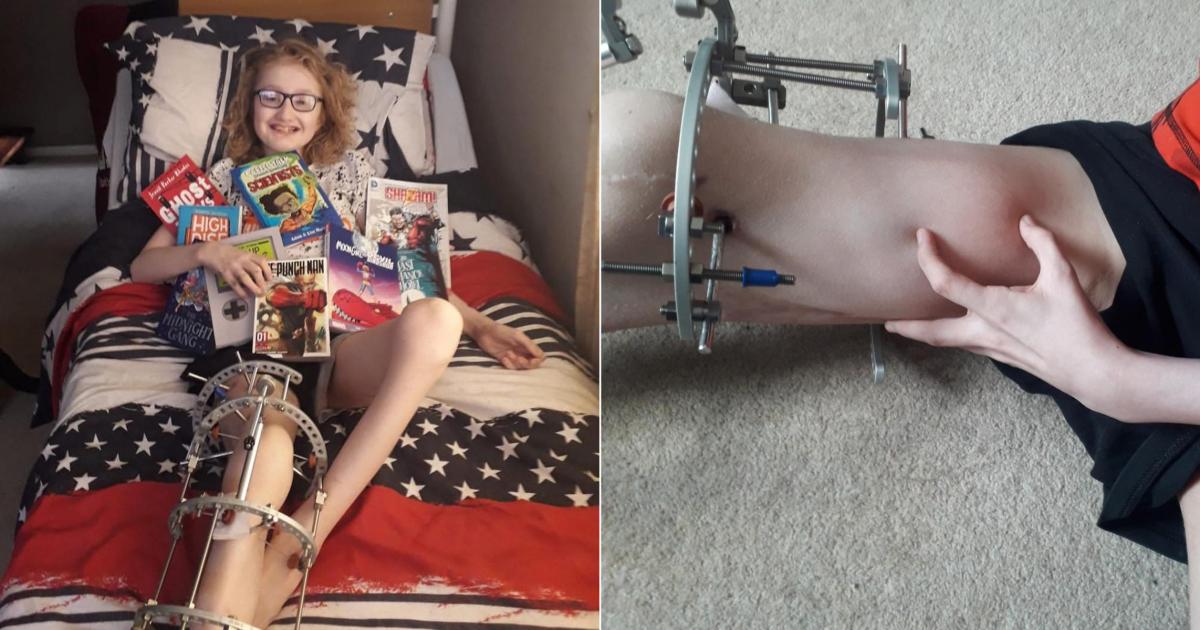 Norfolk teen's ‘horrifying pain’ after botched op by Great Ormond Street surgeon