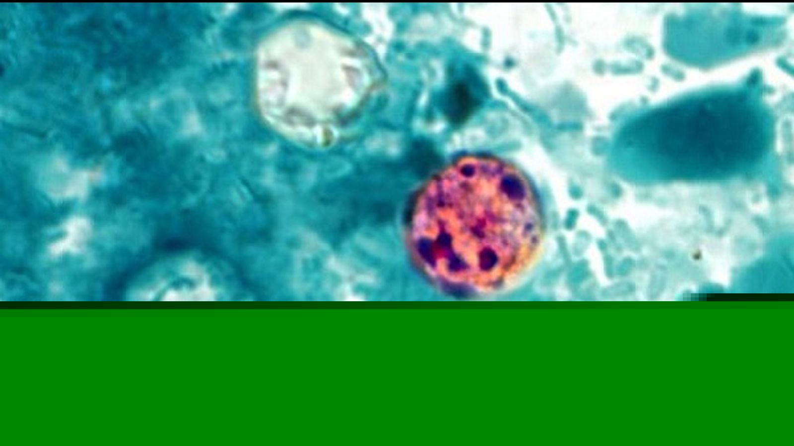First deaths in US cyclosporiasis outbreak reported in Michigan