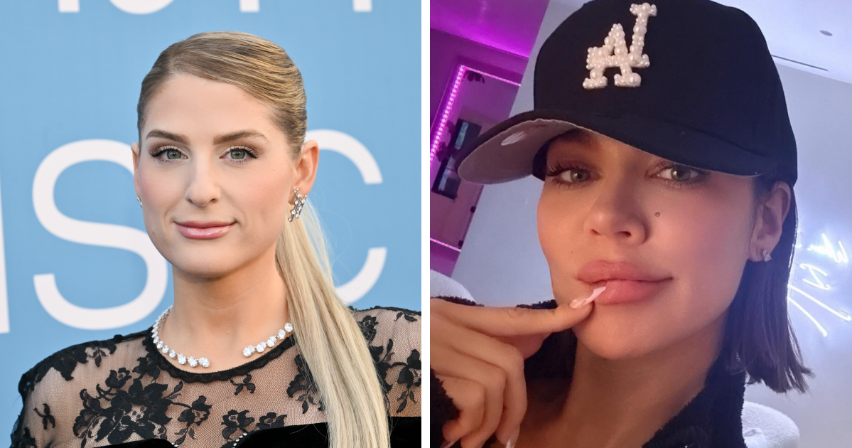 26 Celebrities Before-And-After Photos: Moving From Botox To “Lip Flip”