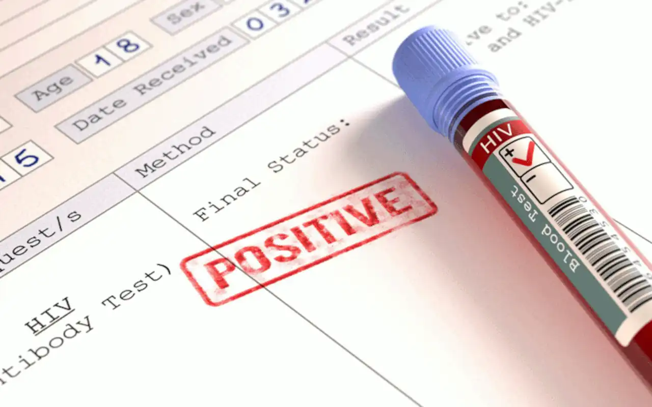 More Than Half Of Harare’s New HIV Cases Are Among 15-To-24-Year-Olds