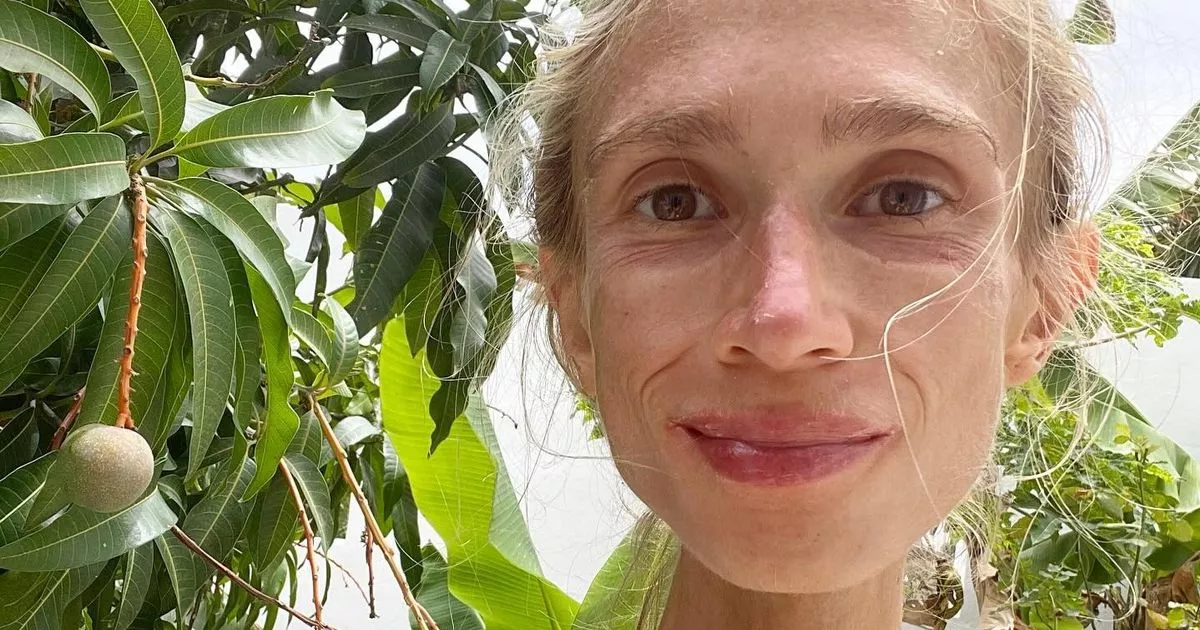UK university graduate who starved to death from fruit diet pleaded for help over symptoms