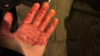 Chelsea fan stabbed in Naples left covered in BLOOD after being attacked with a screwdriver breaks silence on the 'shock' of terrifying ordeal